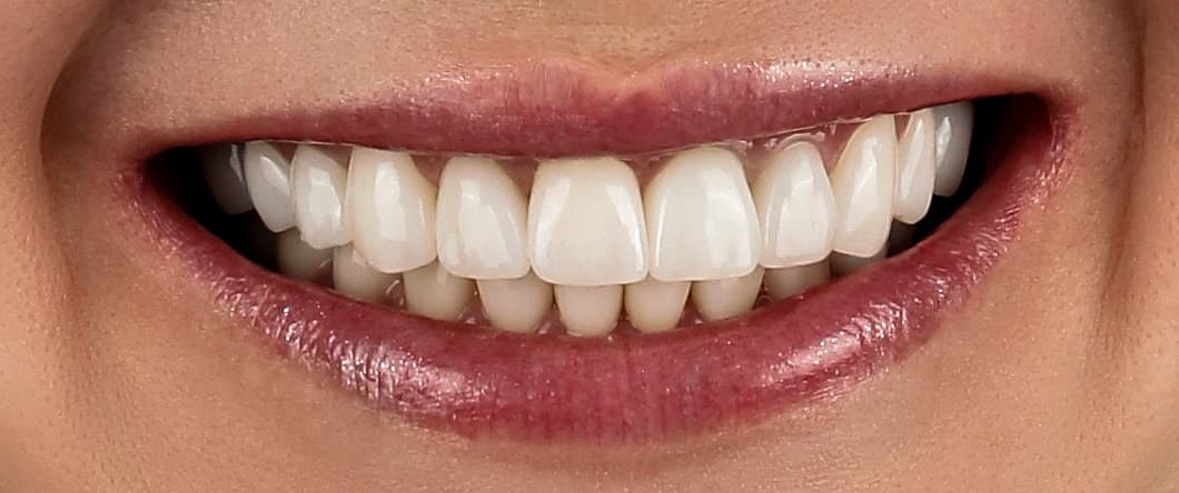 Kuzanov Dent clinic — smile transformations and interior